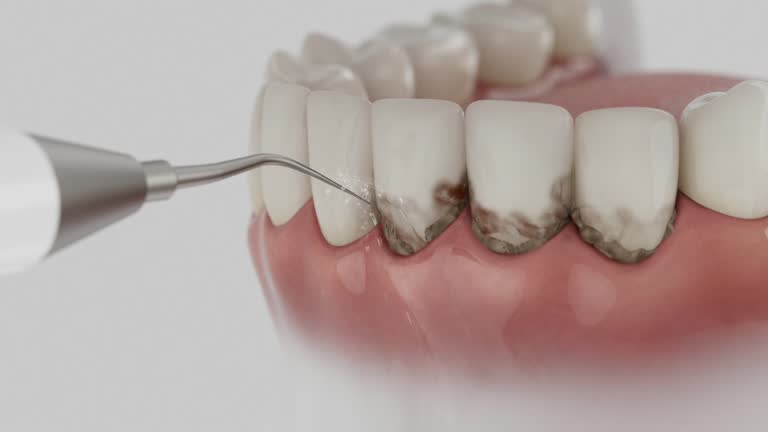 Trusted Dental Implants service in Landen, OH - Dentist Open Now